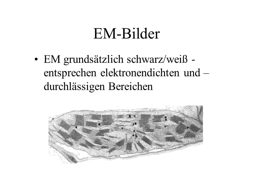 EM-Bilder EM grundsätzlich schwarz/weiß -entsprechen elektronendichten und –durchlässigen Bereichen
