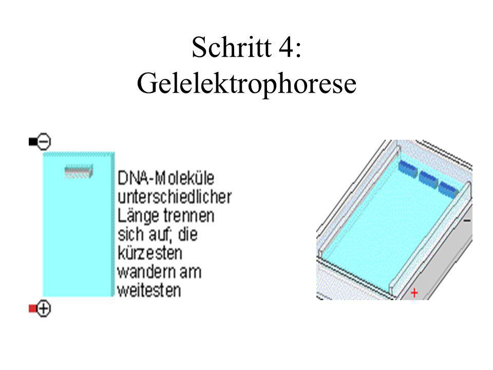 Schritt 4: Gelelektrophorese