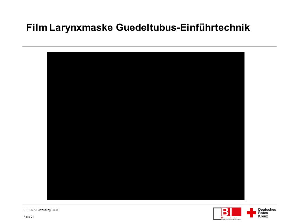 Film Larynxmaske Guedeltubus-Einführtechnik