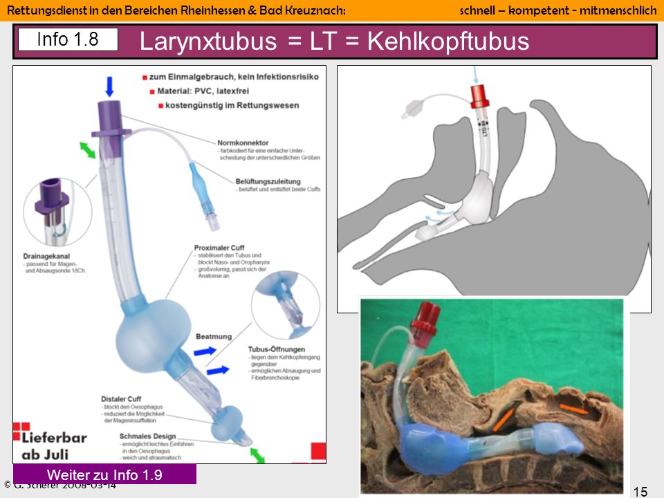 Larynxtubus = LT = Kehlkopftubus