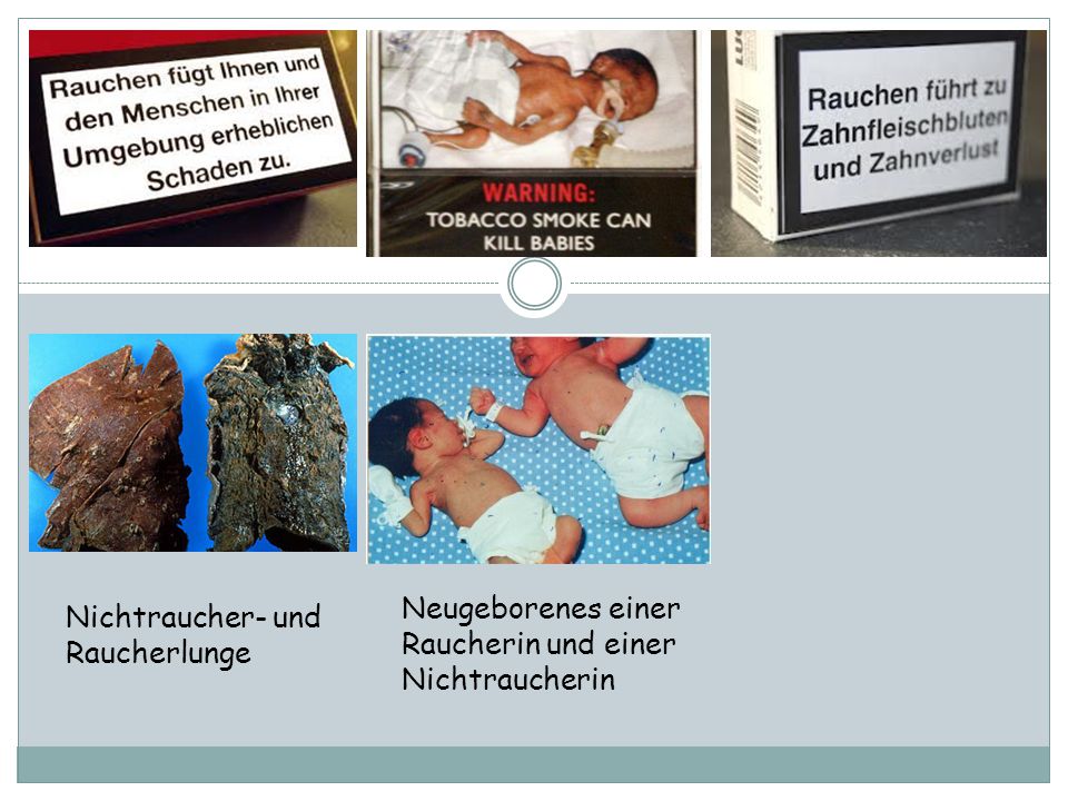 Neugeborenes einer Raucherin und einer Nichtraucherin