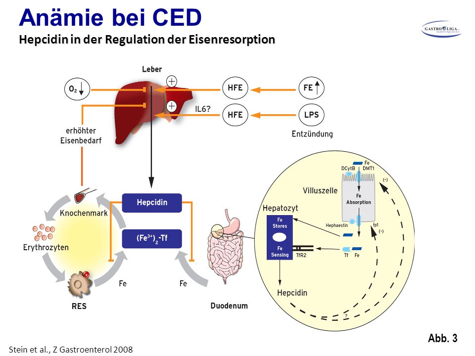 Anämie bei CED Hepcidin in der Regulation der Eisenresorption Abb. 3