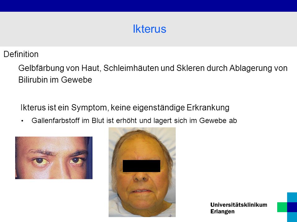Ikterus Definition. Gelbfärbung von Haut, Schleimhäuten und Skleren durch Ablagerung von Bilirubin im Gewebe.
