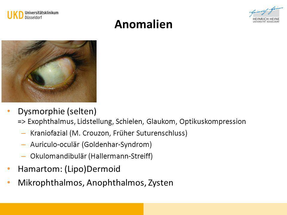 Anomalien Dysmorphie (selten) => Exophthalmus, Lidstellung, Schielen, Glaukom, Optikuskompression. Kraniofazial (M. Crouzon, Früher Suturenschluss)