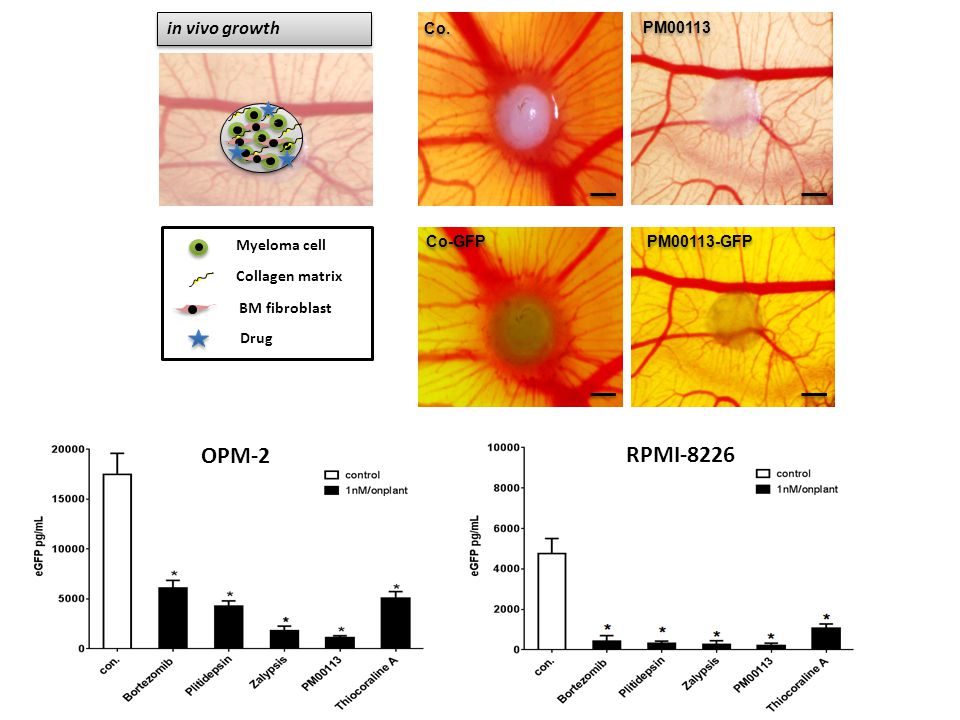 OPM-2 RPMI-8226 in vivo growth Co. PM00113 PM00113-GFP Myeloma cell