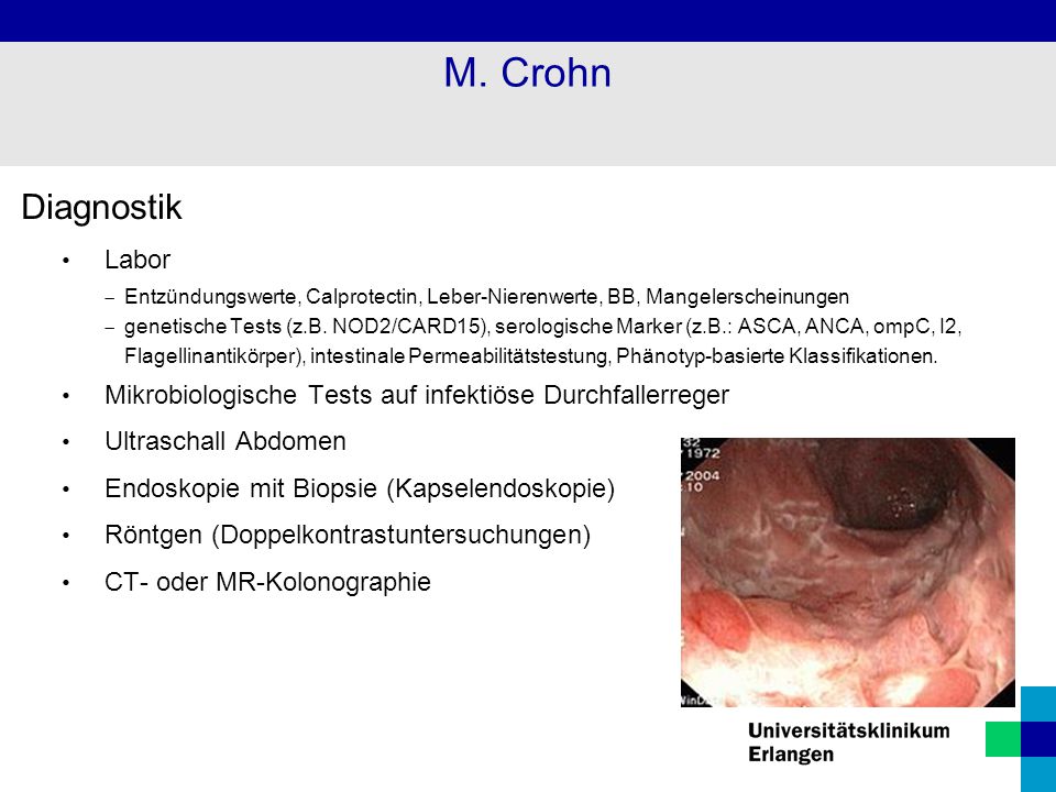 M. Crohn Diagnostik Labor