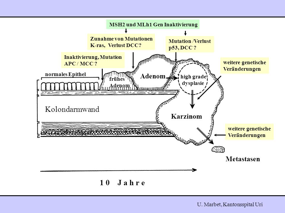 Kolondarmwand 1 0 J a h r e Adenom Karzinom Metastasen