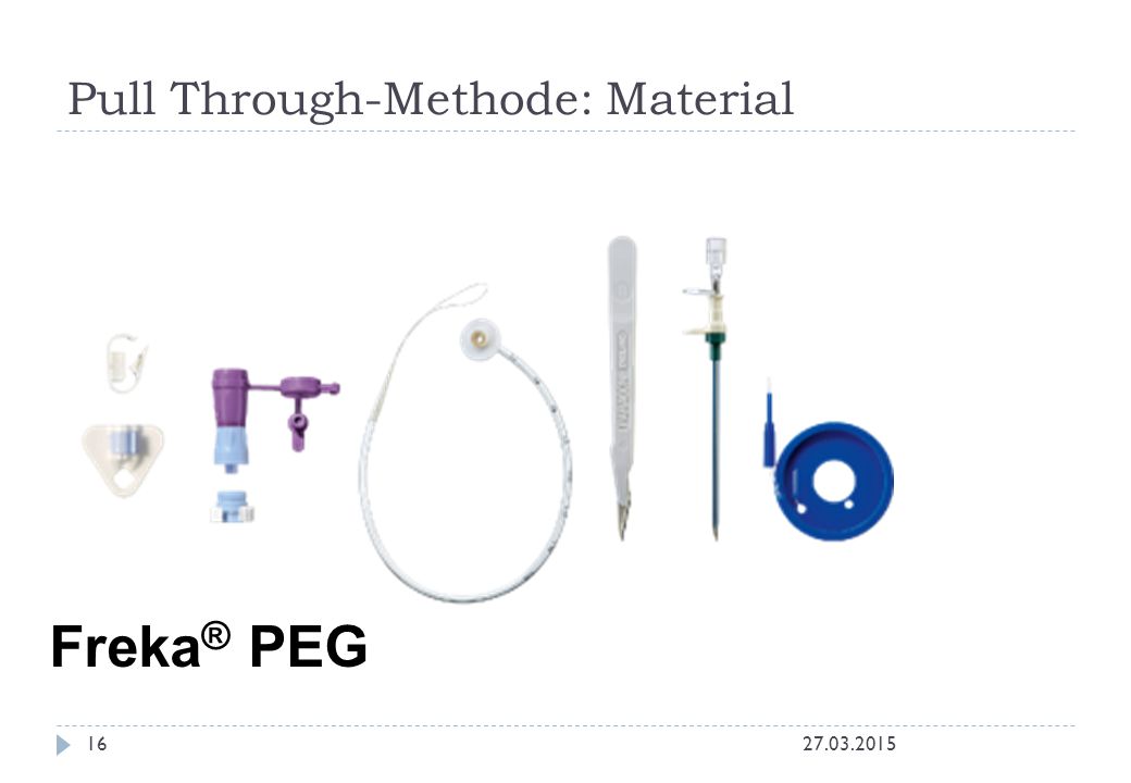 PEG-Workshop Tipps und Tricks mit der lieben Sonde - ppt herunterladen