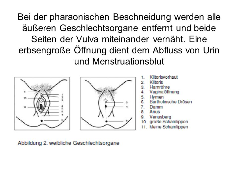 Vorhaut entfernen klitoris Video einer