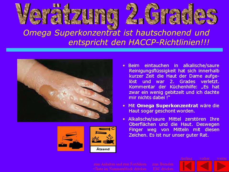 Verätzung 2.Grades Omega Superkonzentrat ist hautschonend und entspricht den HACCP-Richtlinien!!!