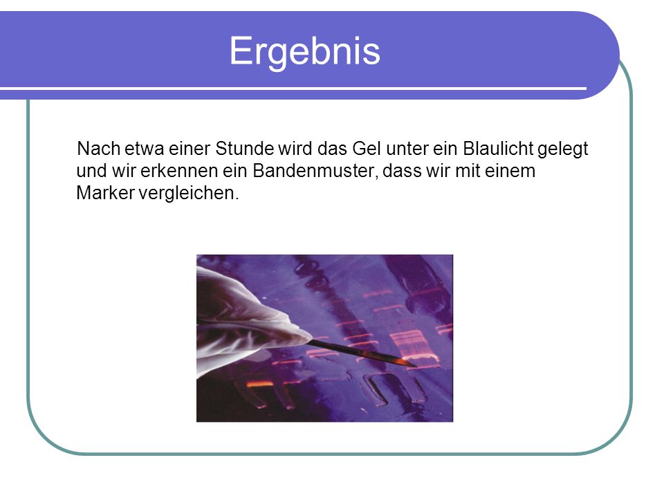Ergebnis Nach etwa einer Stunde wird das Gel unter ein Blaulicht gelegt und wir erkennen ein Bandenmuster, dass wir mit einem Marker vergleichen.