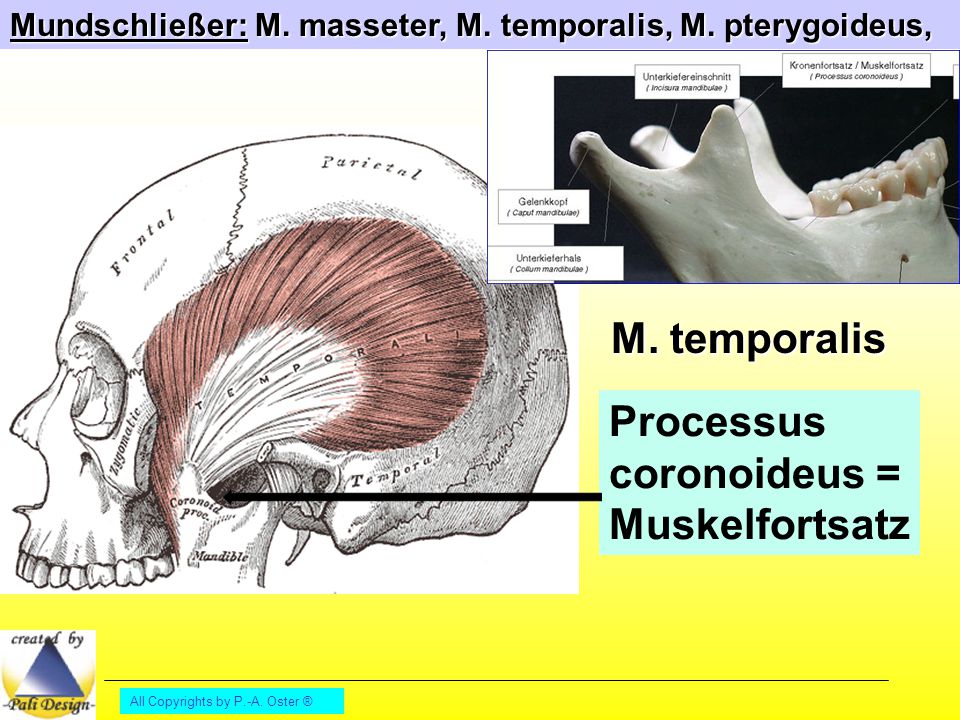 Processus coronoideus = Muskelfortsatz
