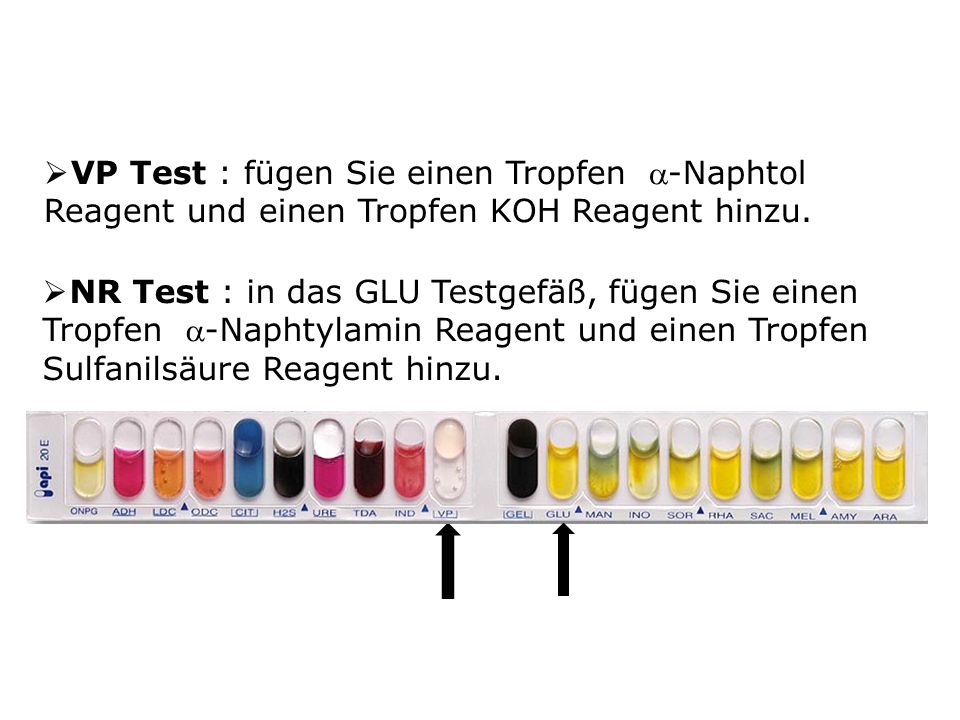 VP Test : fügen Sie einen Tropfen -Naphtol Reagent und einen Tropfen KOH Reagent hinzu.
