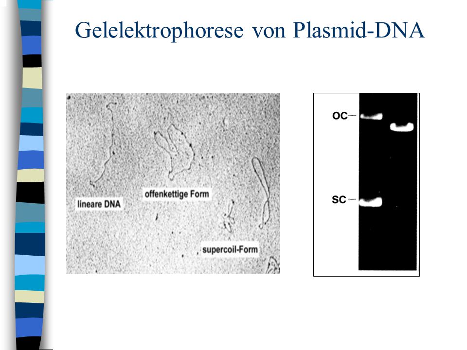 Gelelektrophorese von Plasmid-DNA