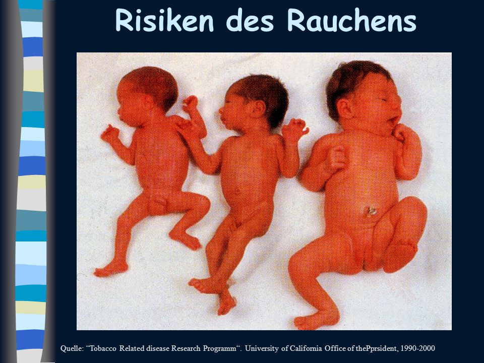 Risiken des Rauchens Quelle: Tobacco Related disease Research Programm .