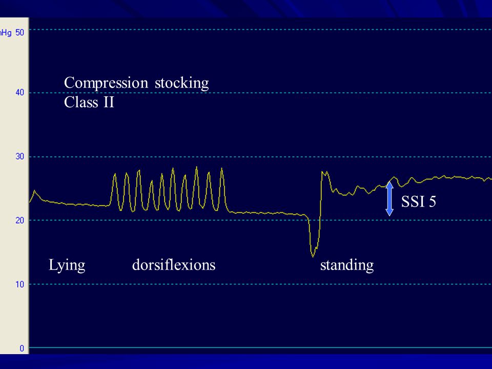 Compression stocking Class II SSI 5 Lying dorsiflexions standing