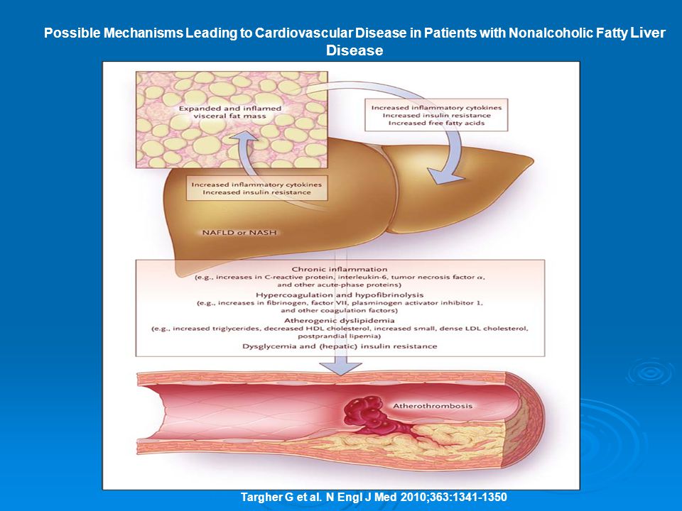Possible Mechanisms Leading to Cardiovascular Disease in Patients with Nonalcoholic Fatty Liver Disease