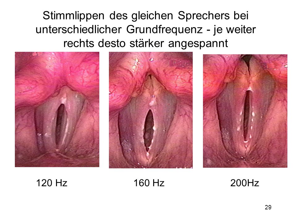 Stimmlippen des gleichen Sprechers bei unterschiedlicher Grundfrequenz - je weiter rechts desto stärker angespannt