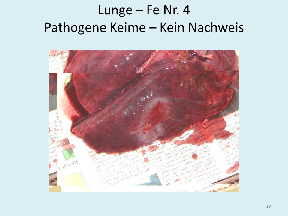 Lunge – Fe Nr. 4 Pathogene Keime – Kein Nachweis