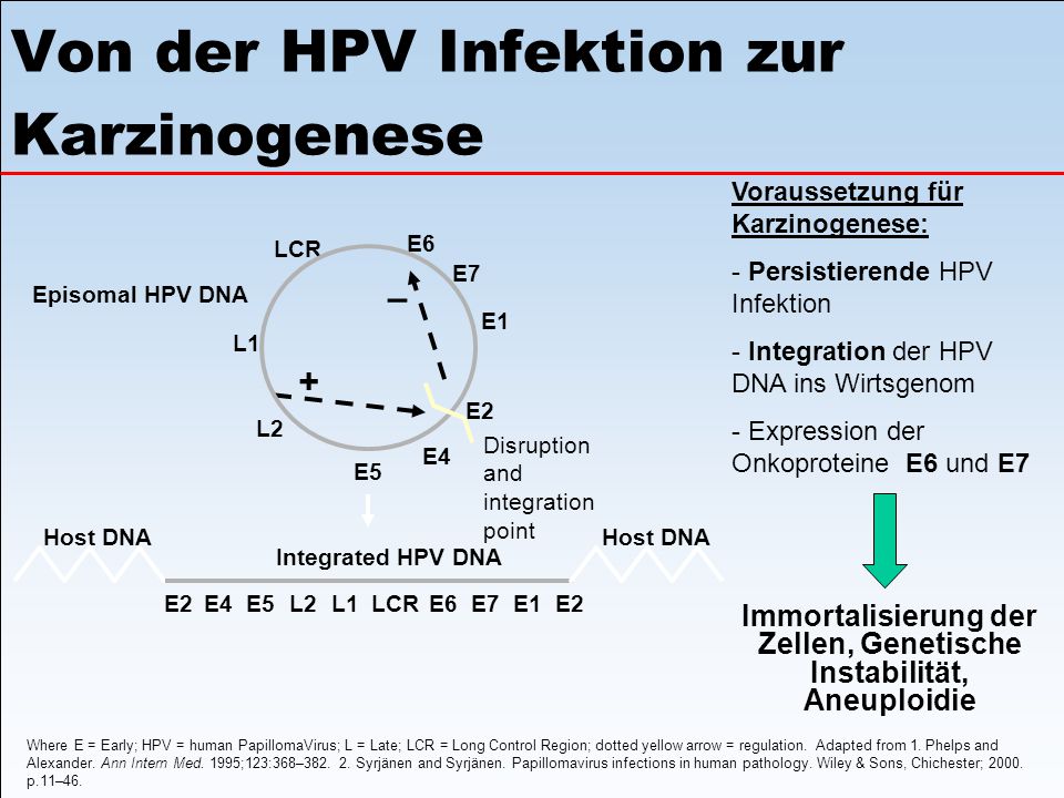 Von der HPV Infektion zur Karzinogenese