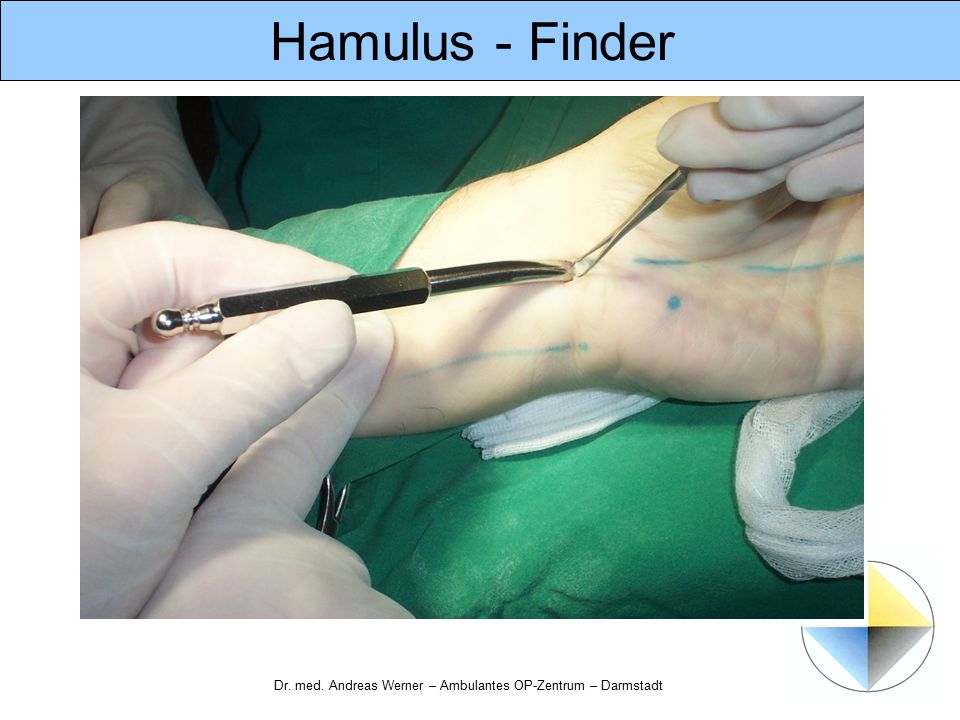 Hamulus - Finder Dr. med. Andreas Werner – Ambulantes OP-Zentrum – Darmstadt