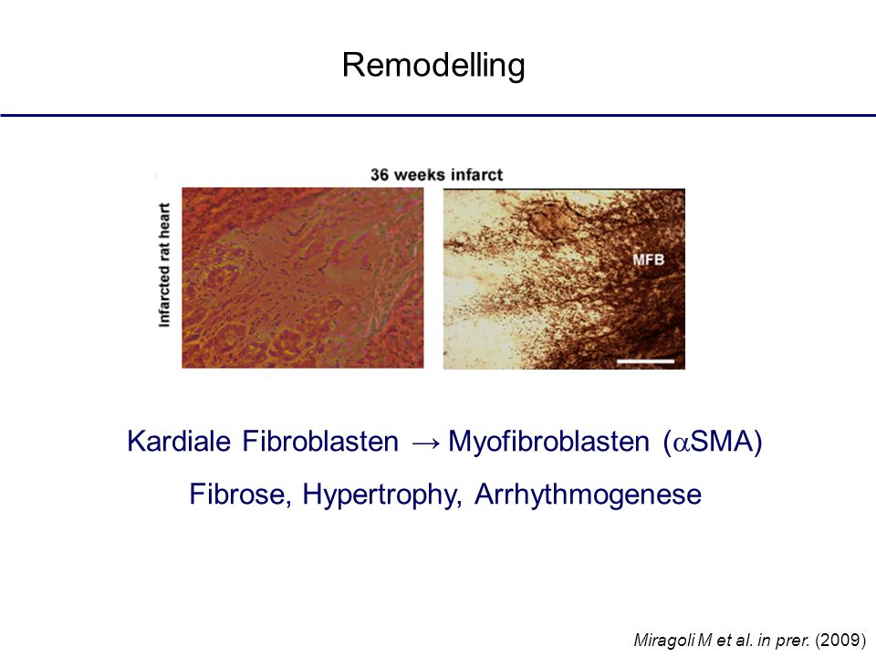Remodelling Kardiale Fibroblasten → Myofibroblasten (aSMA)