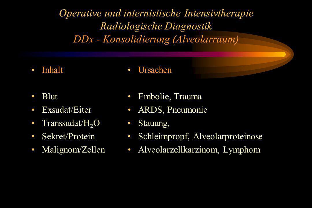 Operative und internistische Intensivtherapie Radiologische Diagnostik DDx - Konsolidierung (Alveolarraum)