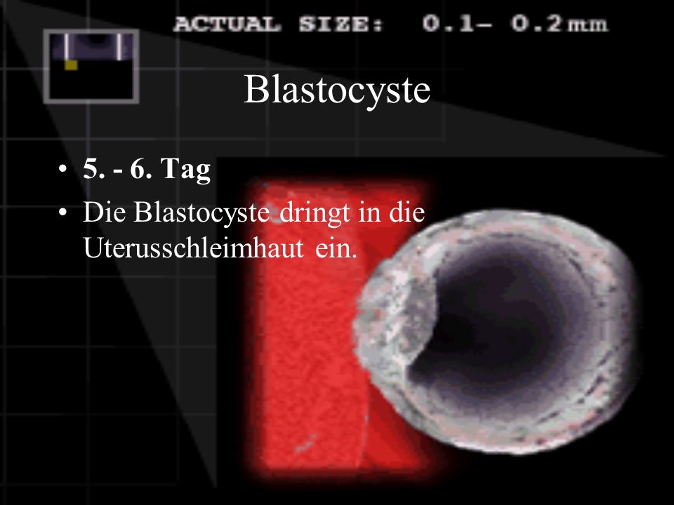 Blastocyste Tag Die Blastocyste dringt in die Uterusschleimhaut ein.