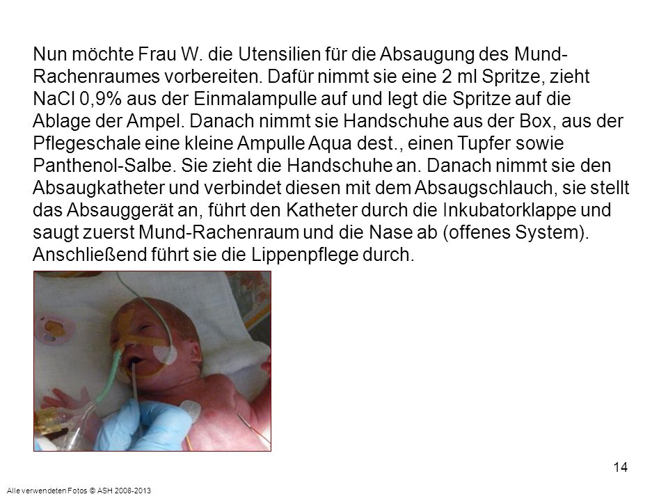 Nun möchte Frau W. die Utensilien für die Absaugung des Mund-Rachenraumes vorbereiten. Dafür nimmt sie eine 2 ml Spritze, zieht NaCl 0,9% aus der Einmalampulle auf und legt die Spritze auf die Ablage der Ampel. Danach nimmt sie Handschuhe aus der Box, aus der Pflegeschale eine kleine Ampulle Aqua dest., einen Tupfer sowie Panthenol-Salbe. Sie zieht die Handschuhe an. Danach nimmt sie den Absaugkatheter und verbindet diesen mit dem Absaugschlauch, sie stellt das Absauggerät an, führt den Katheter durch die Inkubatorklappe und saugt zuerst Mund-Rachenraum und die Nase ab (offenes System). Anschließend führt sie die Lippenpflege durch.