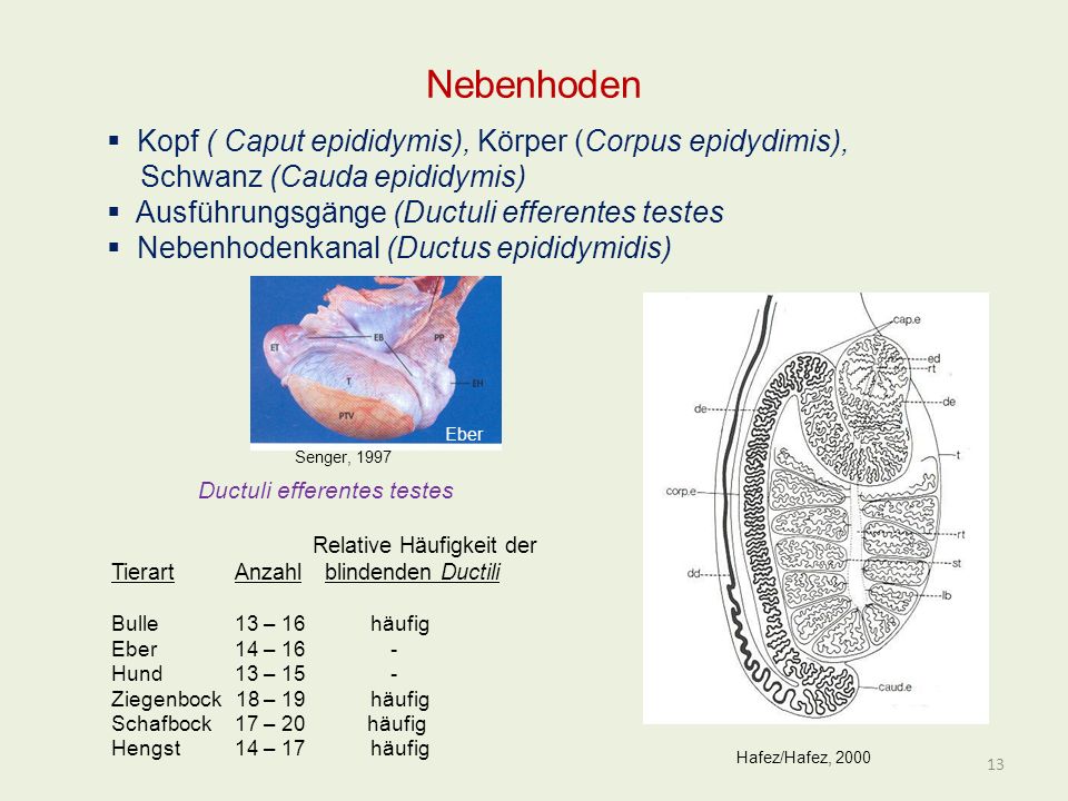 Nebenhoden Kopf ( Caput epididymis), Körper (Corpus epidydimis),