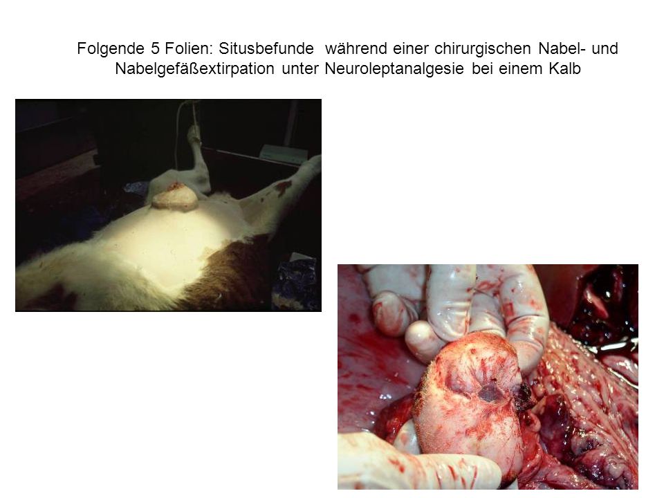 Folgende 5 Folien: Situsbefunde während einer chirurgischen Nabel- und Nabelgefäßextirpation unter Neuroleptanalgesie bei einem Kalb