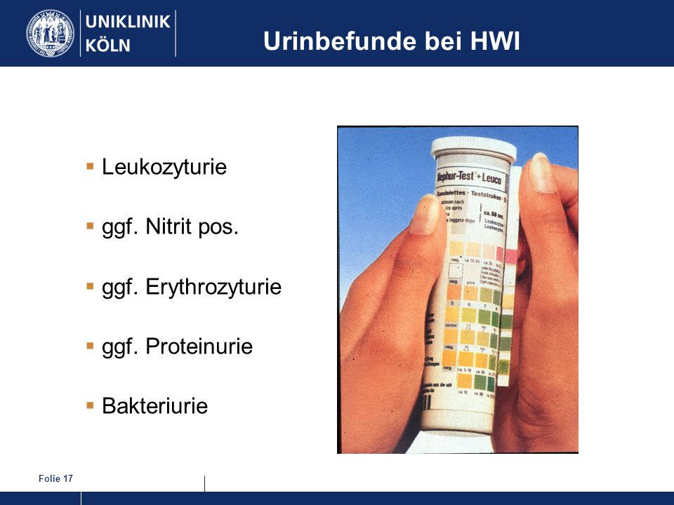 Urinbefunde bei HWI Leukozyturie ggf. Nitrit pos. ggf. Erythrozyturie