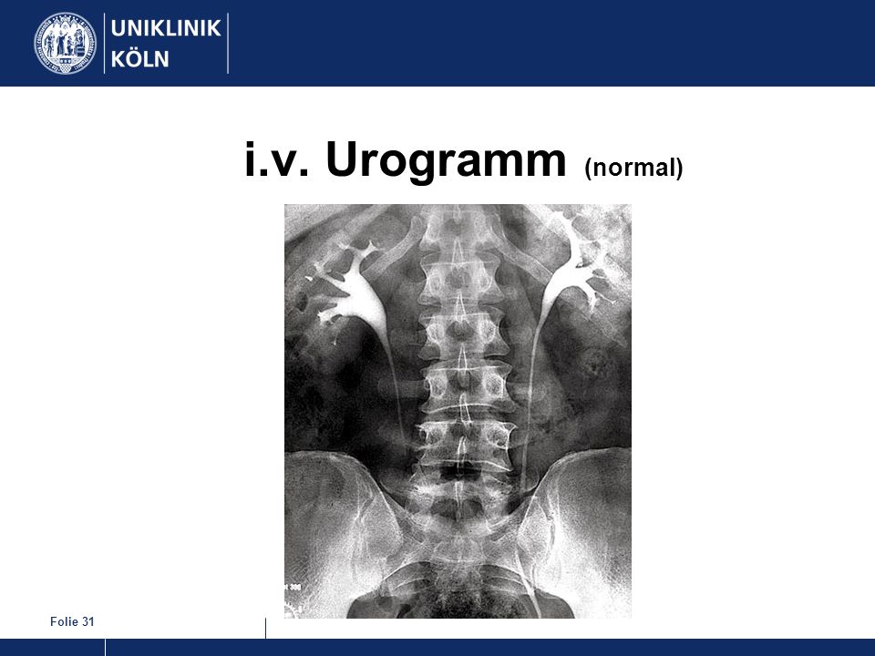 i.v. Urogramm (normal)