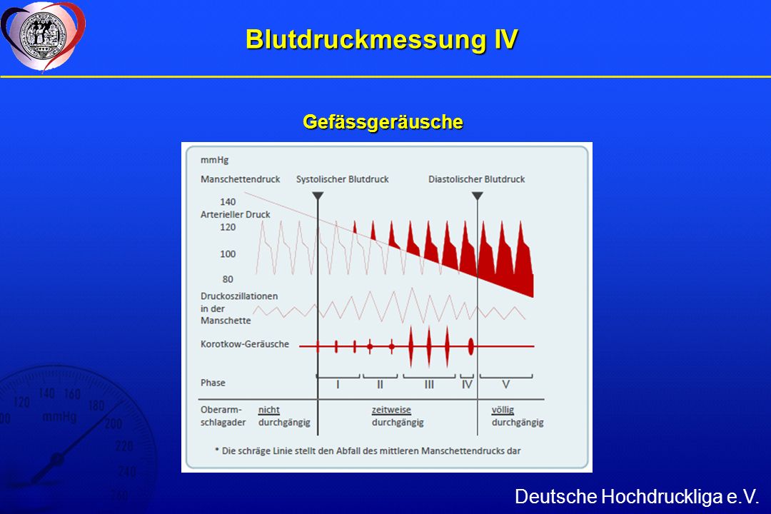 Blutdruckmessung IV Gefässgeräusche Deutsche Hochdruckliga e.V.