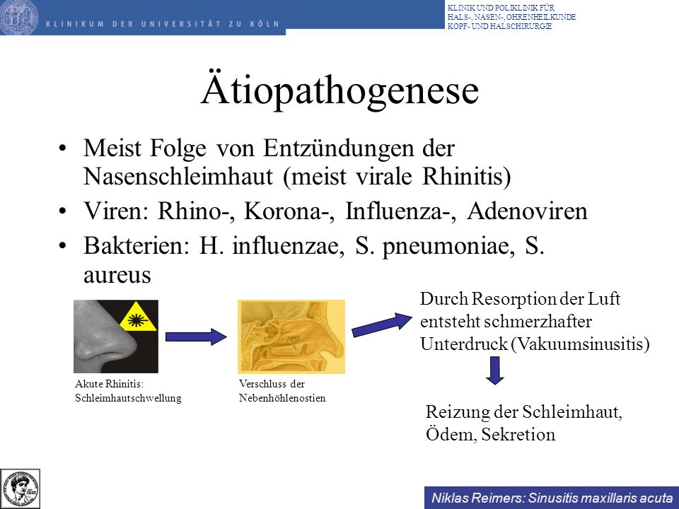 Ätiopathogenese Meist Folge von Entzündungen der Nasenschleimhaut (meist virale Rhinitis) Viren: Rhino-, Korona-, Influenza-, Adenoviren.
