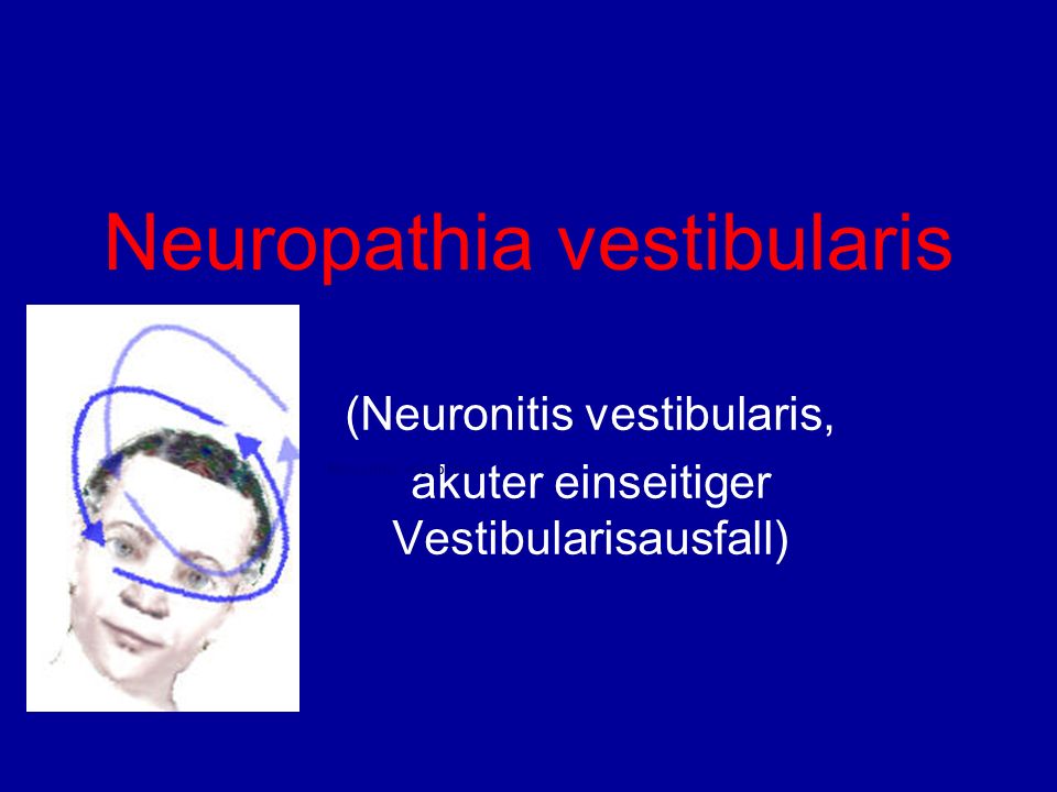 Neuropathia vestibularis