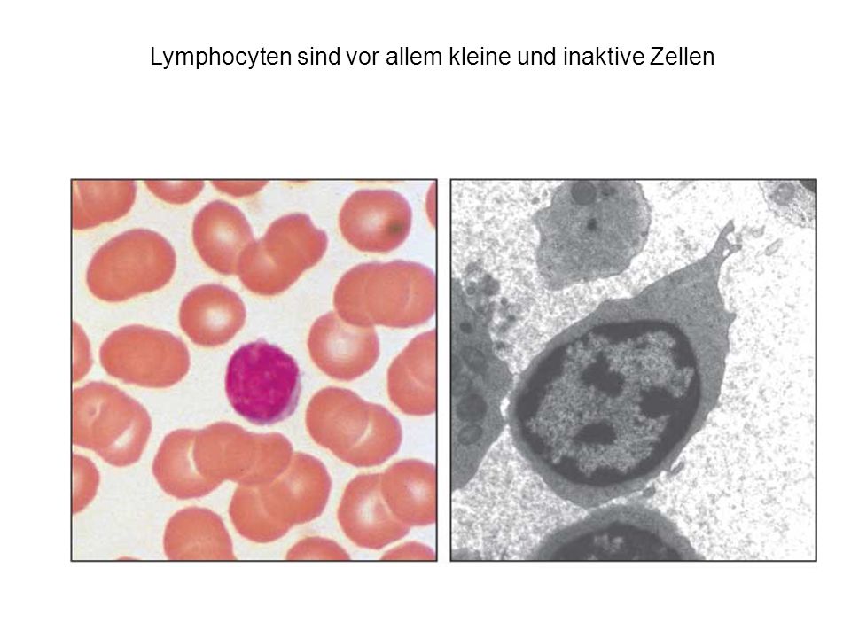 Lymphocyten sind vor allem kleine und inaktive Zellen
