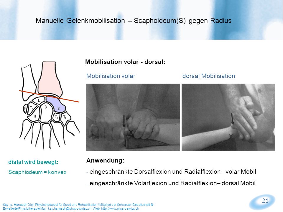 Manuelle Gelenkmobilisation – Scaphoideum(S) gegen Radius