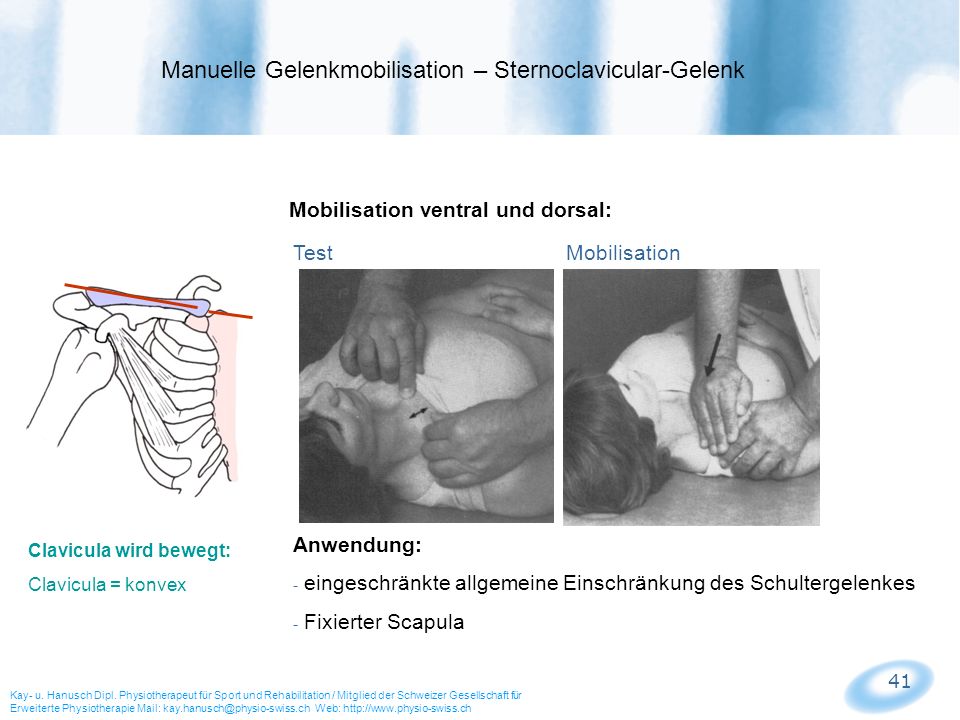 Manuelle Gelenkmobilisation – Sternoclavicular-Gelenk