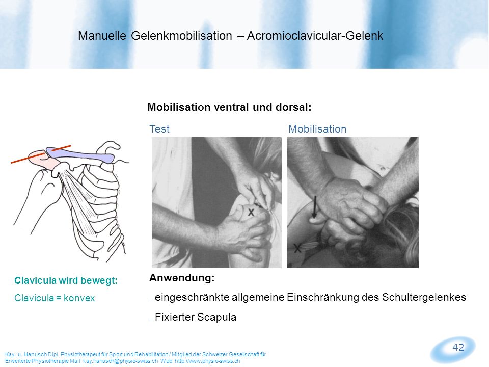Manuelle Gelenkmobilisation – Acromioclavicular-Gelenk