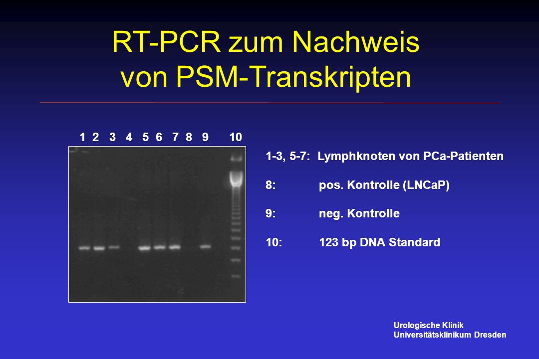 RT-PCR zum Nachweis von PSM-Transkripten