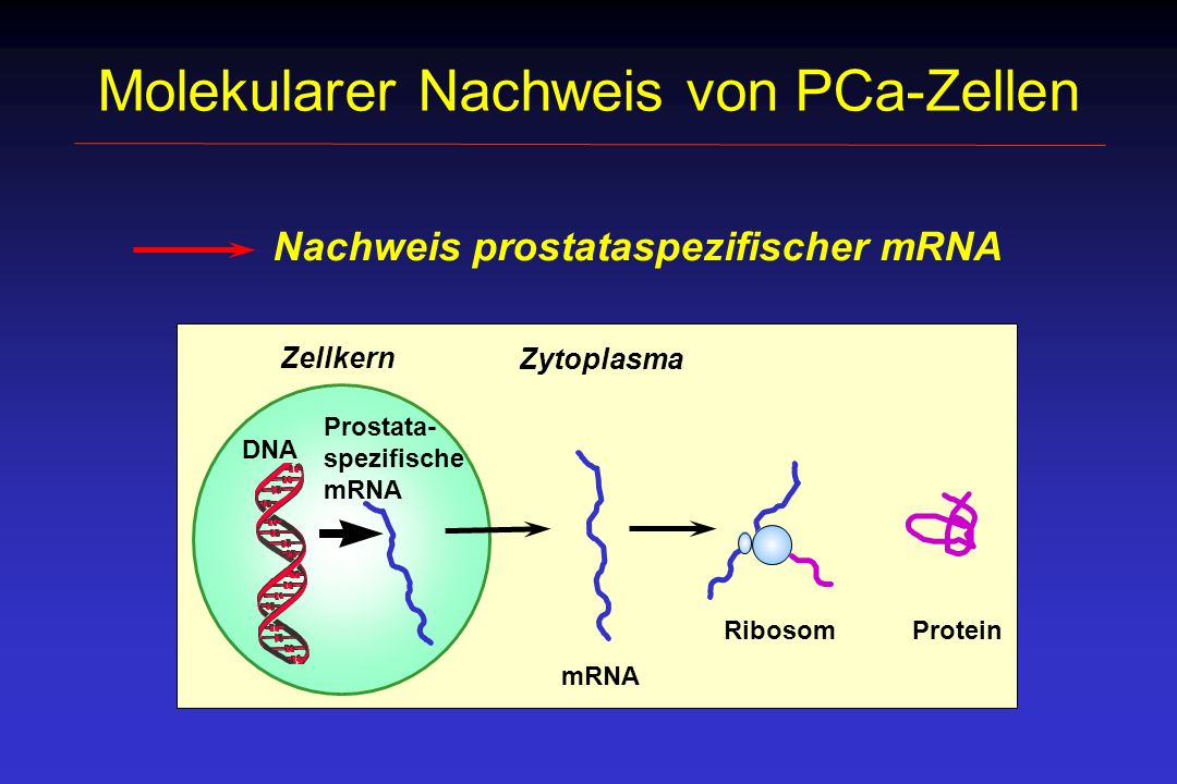 Molekularer Nachweis von PCa-Zellen