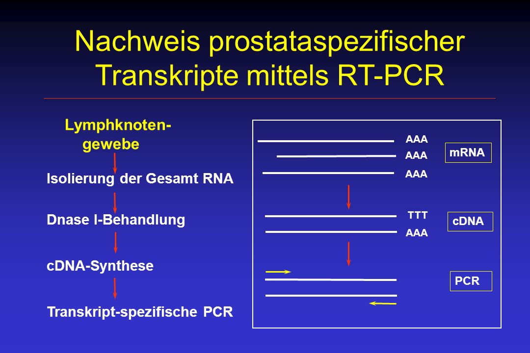 Nachweis prostataspezifischer Transkripte mittels RT-PCR
