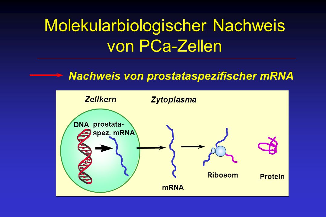 Molekularbiologischer Nachweis von PCa-Zellen