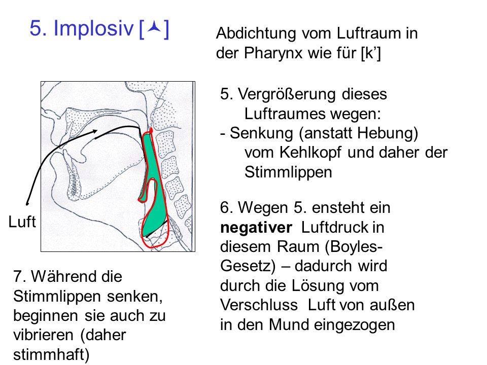5. Implosiv [©] Abdichtung vom Luftraum in der Pharynx wie für [k’]
