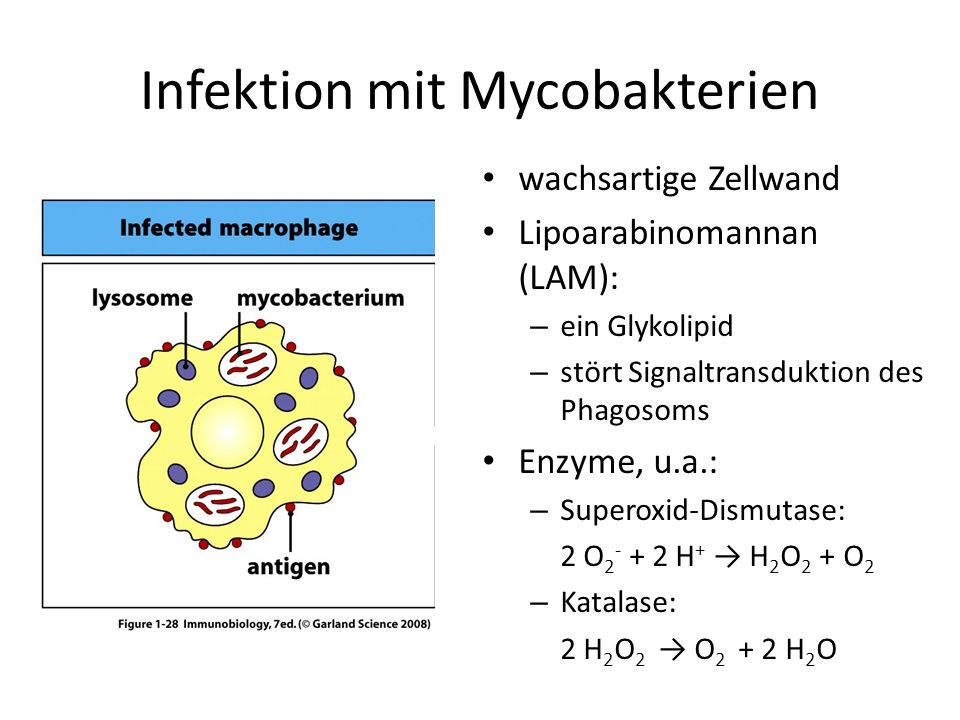 Infektion mit Mycobakterien