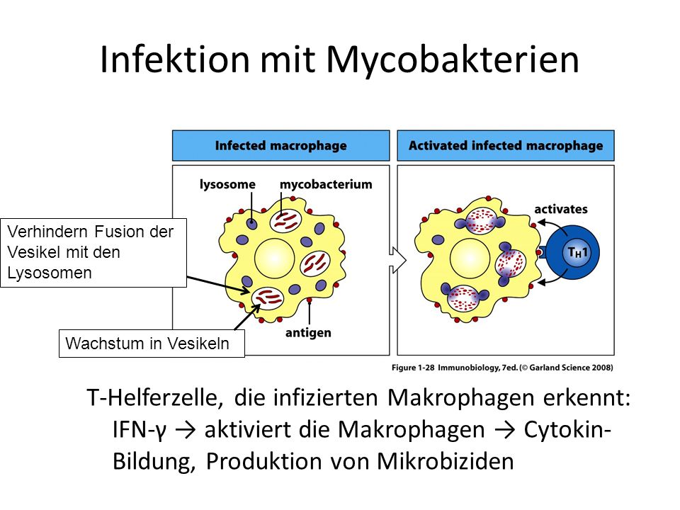 Infektion mit Mycobakterien