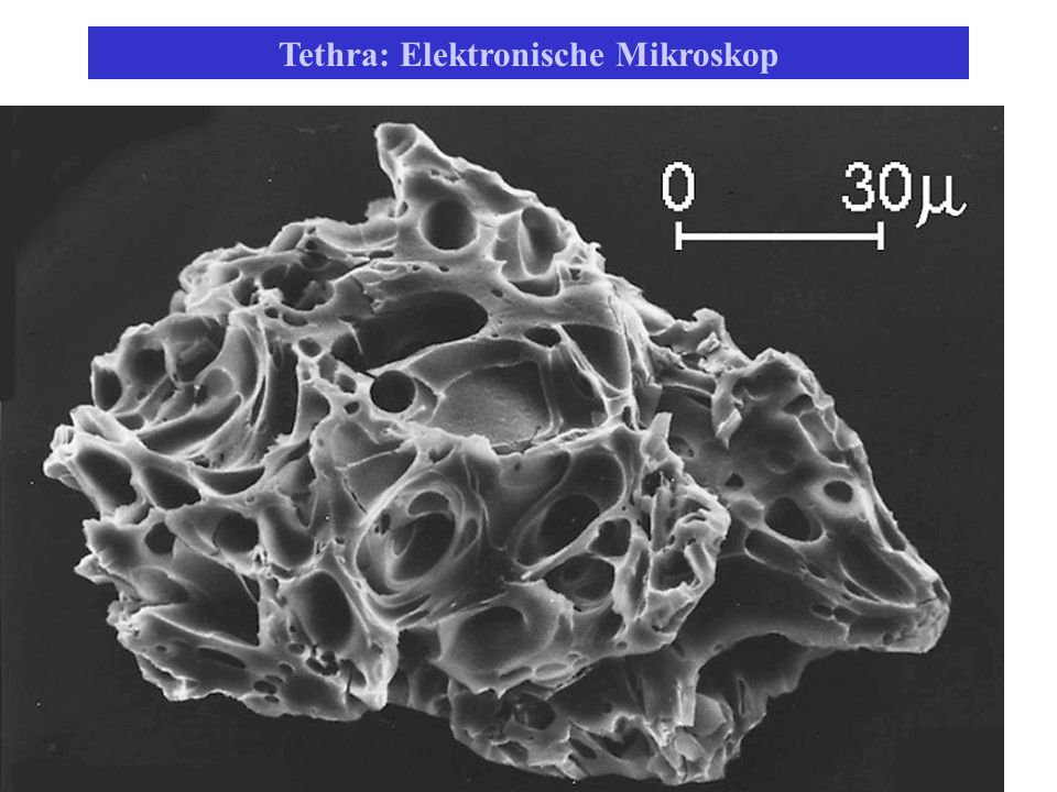 Tethra: Elektronische Mikroskop