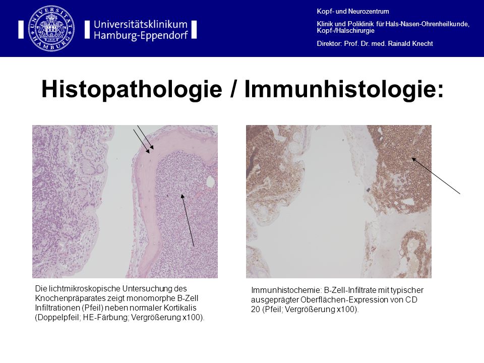 Histopathologie / Immunhistologie: