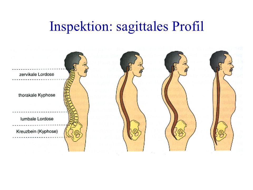 Inspektion: sagittales Profil